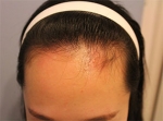 Banobagi Plastic Surgery,Reviews,Images, Promotions, MISOODA — Korea cost, reviews & before-after | MISOODA