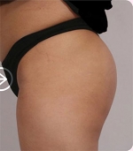 The Plastic Surgery, Reviews,Images, Promotions, — Korea cost, reviews & before-after | MISOODA