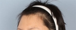 Banobagi Plastic Surgery,Reviews,Images, Promotions, MISOODA — Korea cost, reviews & before-after | MISOODA