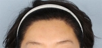 Banobagi Plastic Surgery,Reviews,Images, Promotions, MISOODA — Korea cost, reviews & before-after | MISOODA