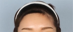 Banobagi Plastic Surgery,Reviews,Images, Promotions, MISOODA — Korea cost, reviews & before-after | MISOODA