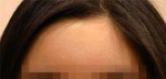 Faceline Plastic Surgery, Reviews,Images,Promotions — Korea cost, reviews & before-after | MISOODA