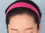 Banobagi Plastic Surgery,Reviews,Images, Promotions, MISOODA — Korea cost, reviews & before-after | MISOODA