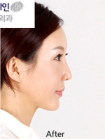 Faceline Plastic Surgery, Reviews,Images,Promotions — Korea cost, reviews & before-after | MISOODA
