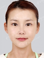 View Plastic Surgery, Reviews, Images, Promotions — Korea cost, reviews & before-after | MISOODA
