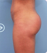The Plastic Surgery, Reviews,Images, Promotions, — Korea cost, reviews & before-after | MISOODA