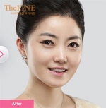 Theline Plastic Surgery,Reviews,Images, Promotions — Korea cost, reviews & before-after | MISOODA