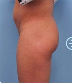 The Plastic Surgery, Reviews,Images, Promotions, — Korea cost, reviews & before-after | MISOODA