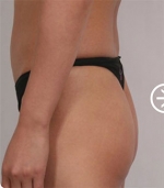 The Plastic Surgery, Reviews,Images, Promotions, — Korea cost, reviews & before-after | MISOODA