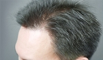 hairline