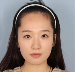 Banobagi Plastic Surgery,Reviews,Images, Promotions, MISOODA — Korea cost, reviews & before-after | MISOODA