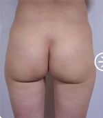 The Plastic Surgery, Reviews,Images, Promotions, — Korea cost, reviews & before-after | MISOODA