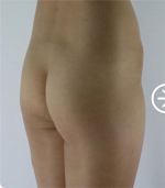 The Plastic Surgery, Reviews,Images, Promotions, — Korea cost, reviews & before-after | MISOODA