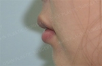 GIRIN Plastic Surgery. GIRIN aesthetic Clinic — Korea cost, reviews & before-after | MISOODA