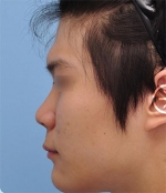 The Plastic Surgery, Reviews,Images, Promotions, — Korea cost, reviews & before-after | MISOODA