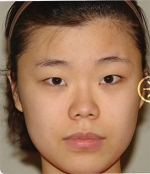 The Plastic Surgery, Reviews,Images, Promotions, — Korea cost, reviews & before-after | MISOODA