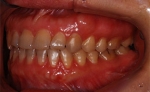 Newface Dental Hospital,Reviews,Images, Promotions — Korea cost, reviews & before-after | MISOODA