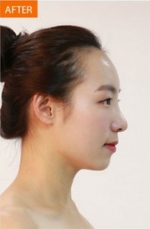 Banobagi Plastic Surgery,Reviews,Images, Promotions, MISOODA — Korea cost, reviews & before-after | MISOODA