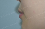 GIRIN Plastic Surgery. GIRIN aesthetic Clinic — Korea cost, reviews & before-after | MISOODA