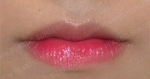 GIRIN Plastic Surgery. GIRIN aesthetic Clinic — Korea cost, reviews & before-after | MISOODA
