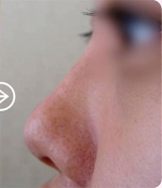 The Plastic Surgery, Reviews,Images, Promotions, — Korea cost, reviews & before-after | MISOODA
