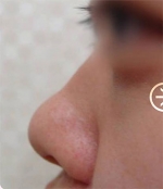The Plastic Surgery, Reviews,Images, Promotions, — Korea cost, reviews & before-after | MISOODA