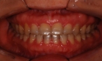 Newface Dental Hospital,Reviews,Images, Promotions — Korea cost, reviews & before-after | MISOODA