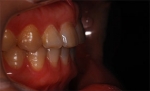 Newface Dental Hospital,Reviews,Images, Promotions — Korea cost, reviews & before-after | MISOODA