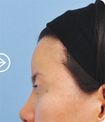 The Plastic Surgery, Reviews,Images, Promotions, — Korea cost, reviews & before-after | MISOODA