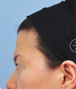 The Plastic Surgery, Reviews,Images, Promotions, — Korea cost, reviews & before-after | MISOODA