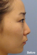 Banobagi Plastic Surgery,Reviews,Images, Promotions, MISOODA — Korea cost, reviews & before-after | MISOODA
