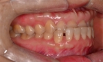 Newface Dental Hospital,Reviews,Images, Promotions — Korea cost, reviews & before-after | MISOODA