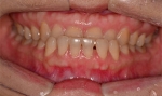 Newface Dental Hospital,Reviews,Images, Promotions — Korea cost, reviews & before-after | MISOODA
