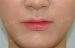 GIRIN Plastic Surgery. GIRIN aesthetic Clinic — Korea cost, reviews & before-after | MISOODA