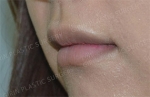 GIRIN Plastic Surgery. GIRIN aesthetic Clinic — Korea cost, reviews & before-after | MISOODA