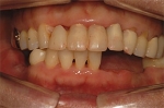 Newface Dental Hospital,Reviews,Images, Promotions — Korea cost, reviews & before-after | MISOODA