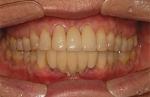 Newface Dental Hospital,Reviews,Images, Promotions — Korea cost, reviews & before-after | MISOODA