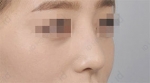ID Plastic Surgery , Reviews, Images, Promotions — Korea cost, reviews & before-after | MISOODA