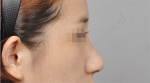 ID Plastic Surgery , Reviews, Images, Promotions — Korea cost, reviews & before-after | MISOODA