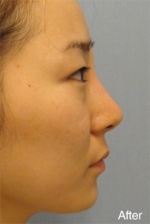 Banobagi Plastic Surgery,Reviews,Images, Promotions, MISOODA — Korea cost, reviews & before-after | MISOODA