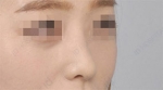 ID Plastic Surgery , Reviews, Images, Promotions — Korea cost, reviews & before-after | MISOODA
