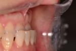 Newface Dental Hospital,Reviews,Images, Promotions — Korea cost, reviews & before-after | MISOODA