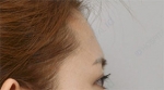 ID Plastic Surgery , Reviews, Images, Promotions — Korea cost, reviews & before-after | MISOODA