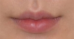 GIRIN Plastic Surgery. GIRIN aesthetic Clinic — Korea cost, reviews & before-after | MISOODA