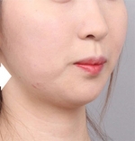 DA Plastic Surgery, Reviews, Images, Promotions — Korea cost, reviews & before-after | MISOODA
