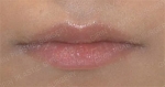 GIRIN Plastic Surgery. GIRIN aesthetic Clinic — Korea cost, reviews & before-after | MISOODA