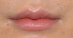 GIRIN Plastic Surgery. GIRIN aesthetic Clinic — Korea cost, reviews & before-after | MISOODA