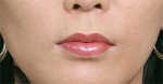 lip