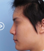 The Plastic Surgery, Reviews,Images, Promotions, — Korea cost, reviews & before-after | MISOODA