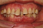 Newface Dental Hospital,Reviews,Images, Promotions — Korea cost, reviews & before-after | MISOODA